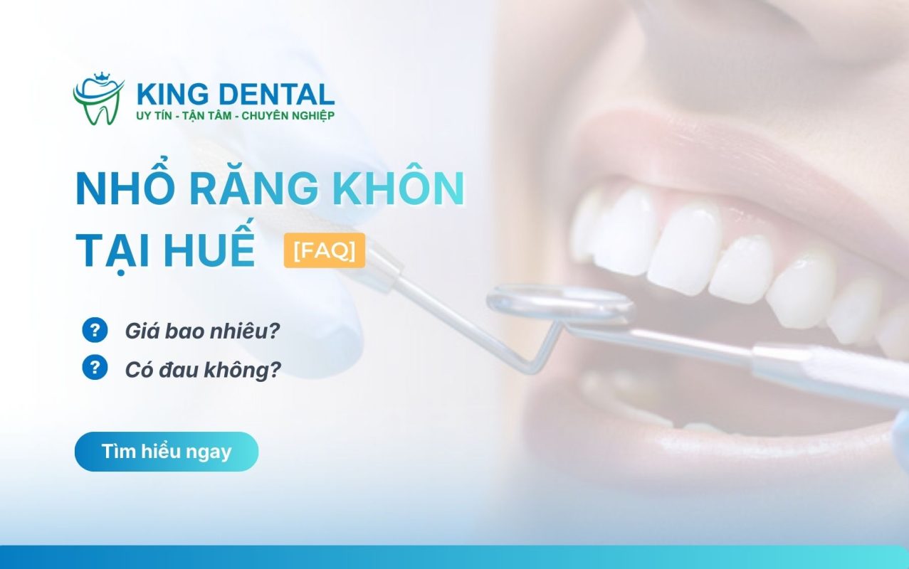 Nhổ răng khôn tại Huế