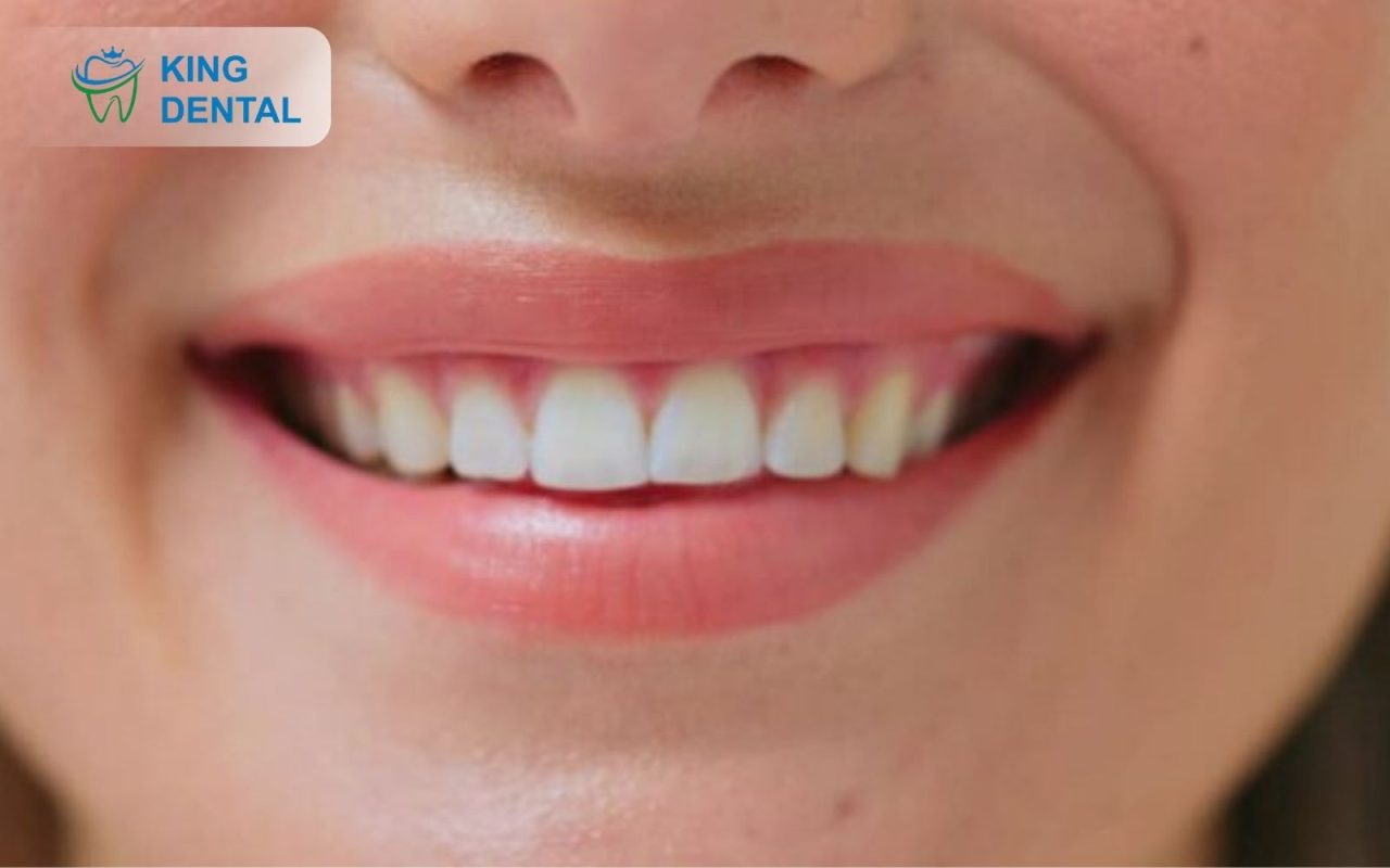 Nhổ răng khôn không đau