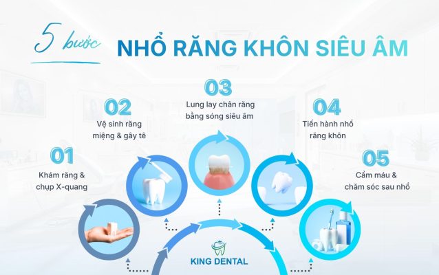 5 bước nhổ răng khôn siêu âm
