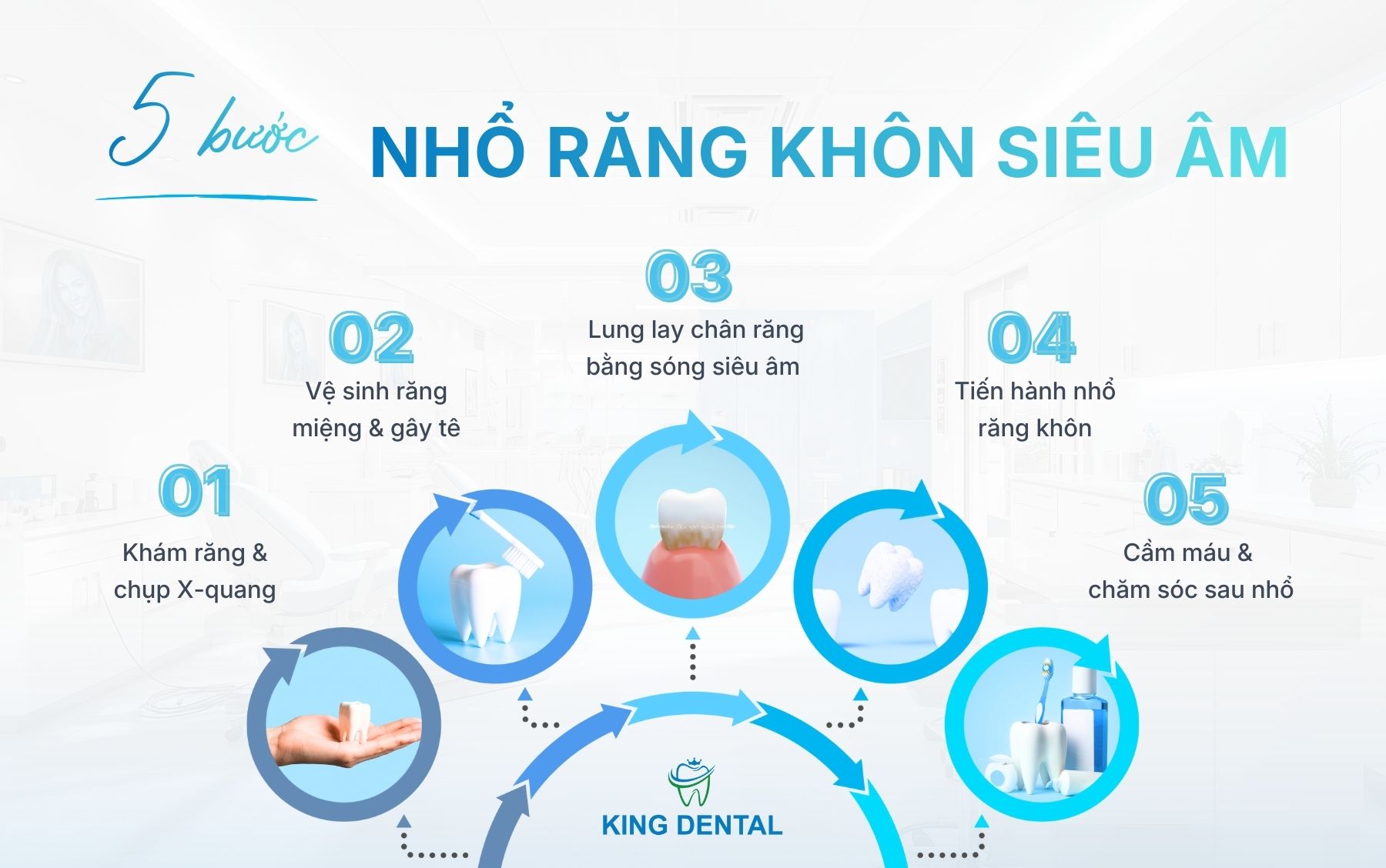 5 bước nhổ răng khôn siêu âm