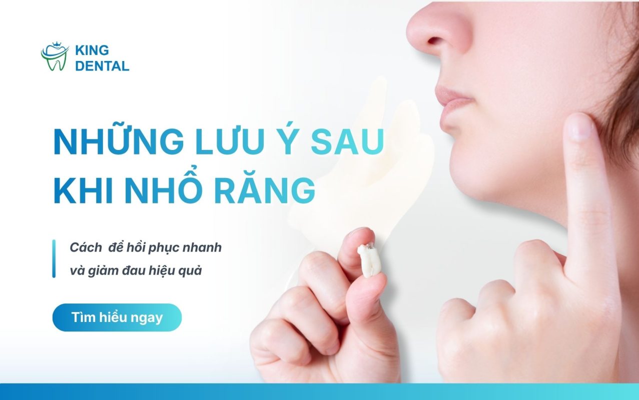 Lưu ý sau nhổ răng