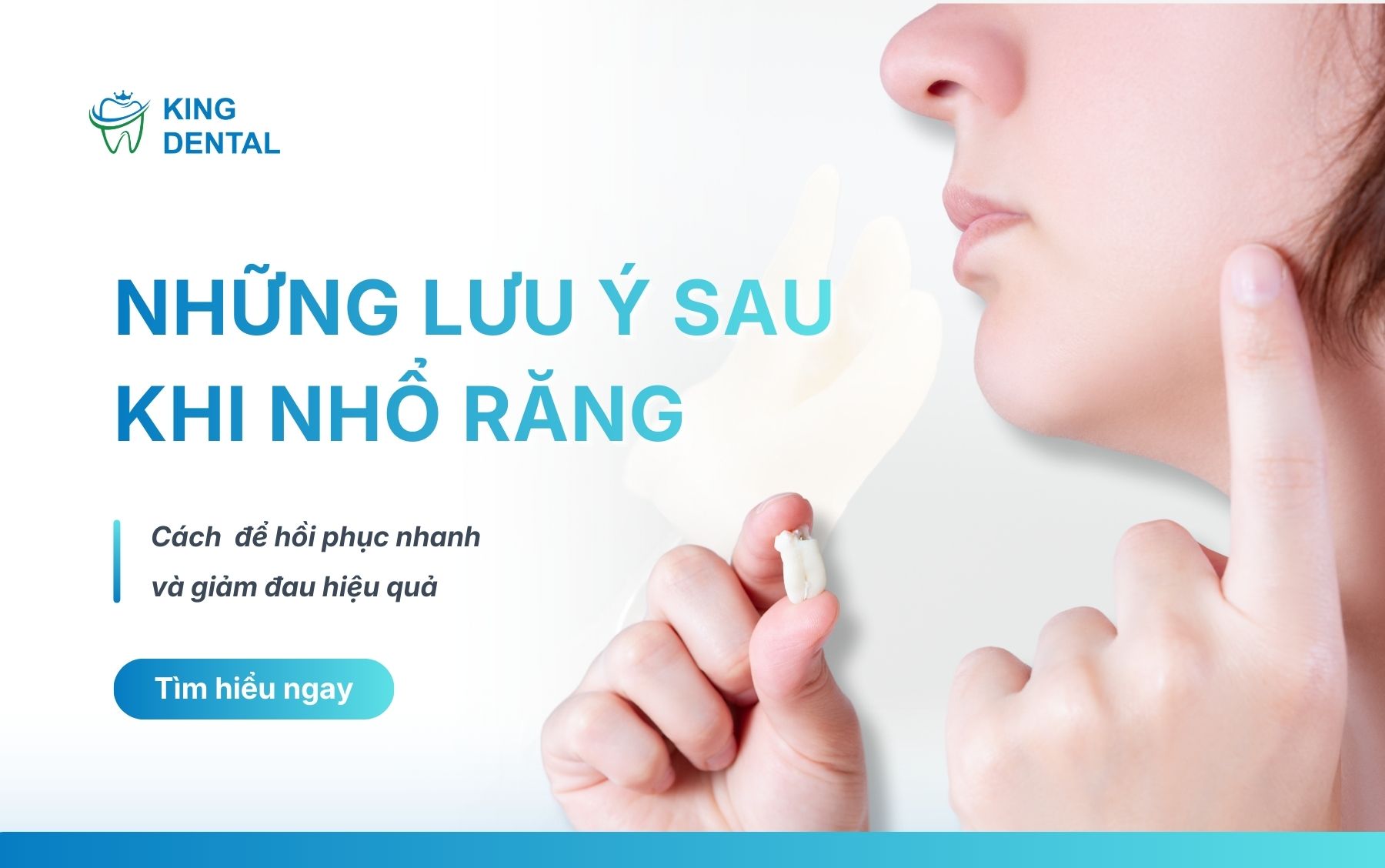 Lưu ý sau nhổ răng