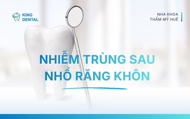 Nhiễm trùng sau nhổ răng khôn
