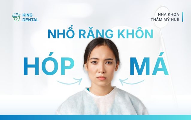 Nhổ răng khôn bị hóp má