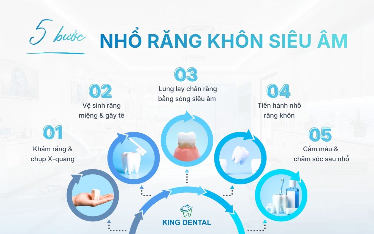 5 bước nhổ răng khôn siêu âm