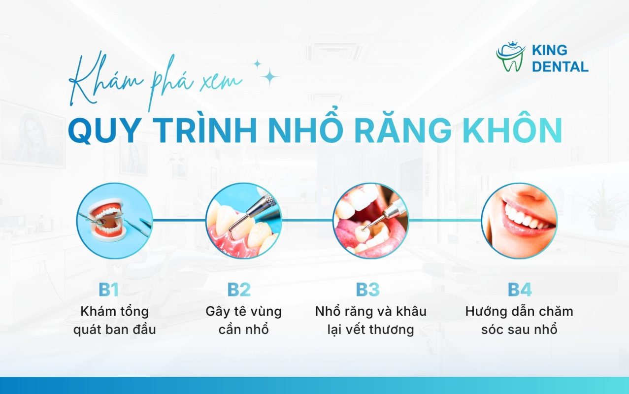 Quy trình nhổ răng khôn
