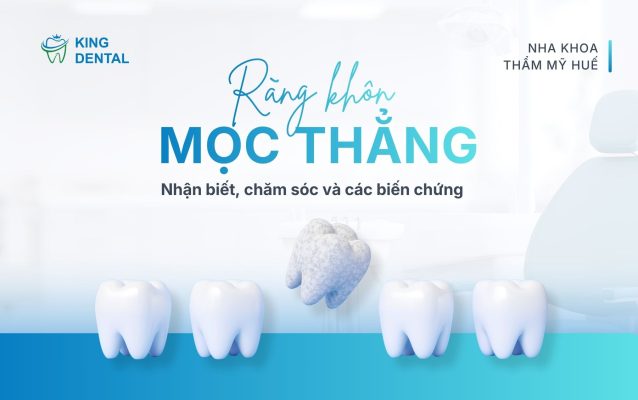 Răng khôn mọc thẳng, nhận biết, chăm sóc