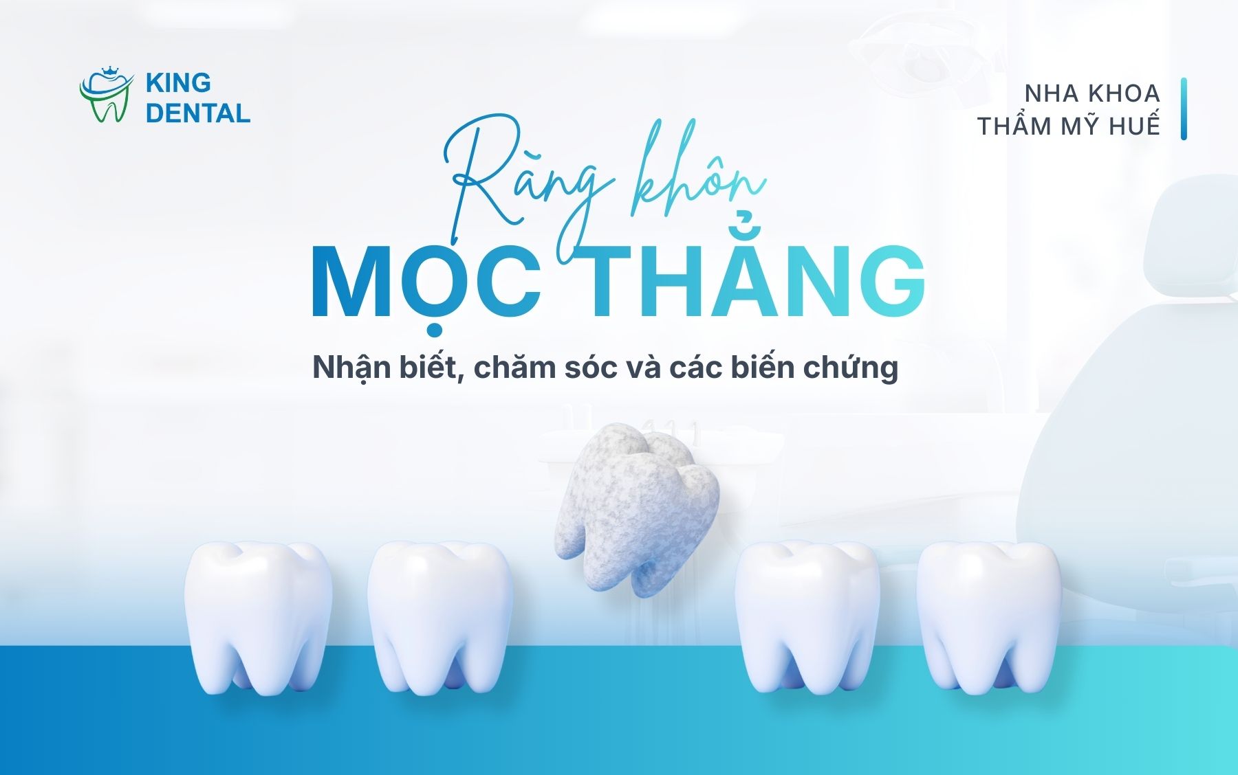 Răng khôn mọc thẳng, nhận biết, chăm sóc