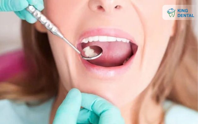 răng khôn nằm ở đâu