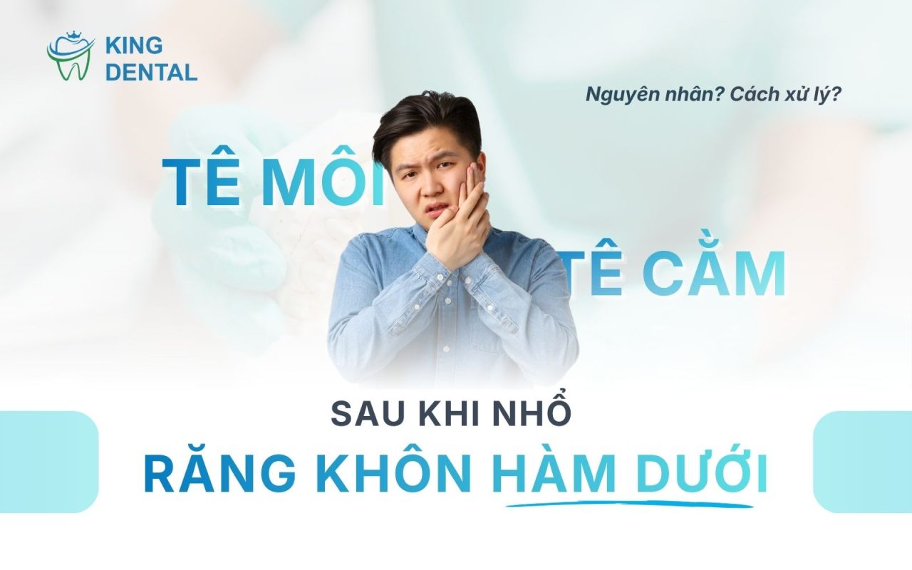 Tê môi sau nhổ răng khôn hàm dưới