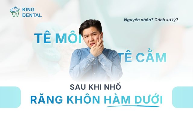tê môi sau nhổ răng khôn hàm dưới