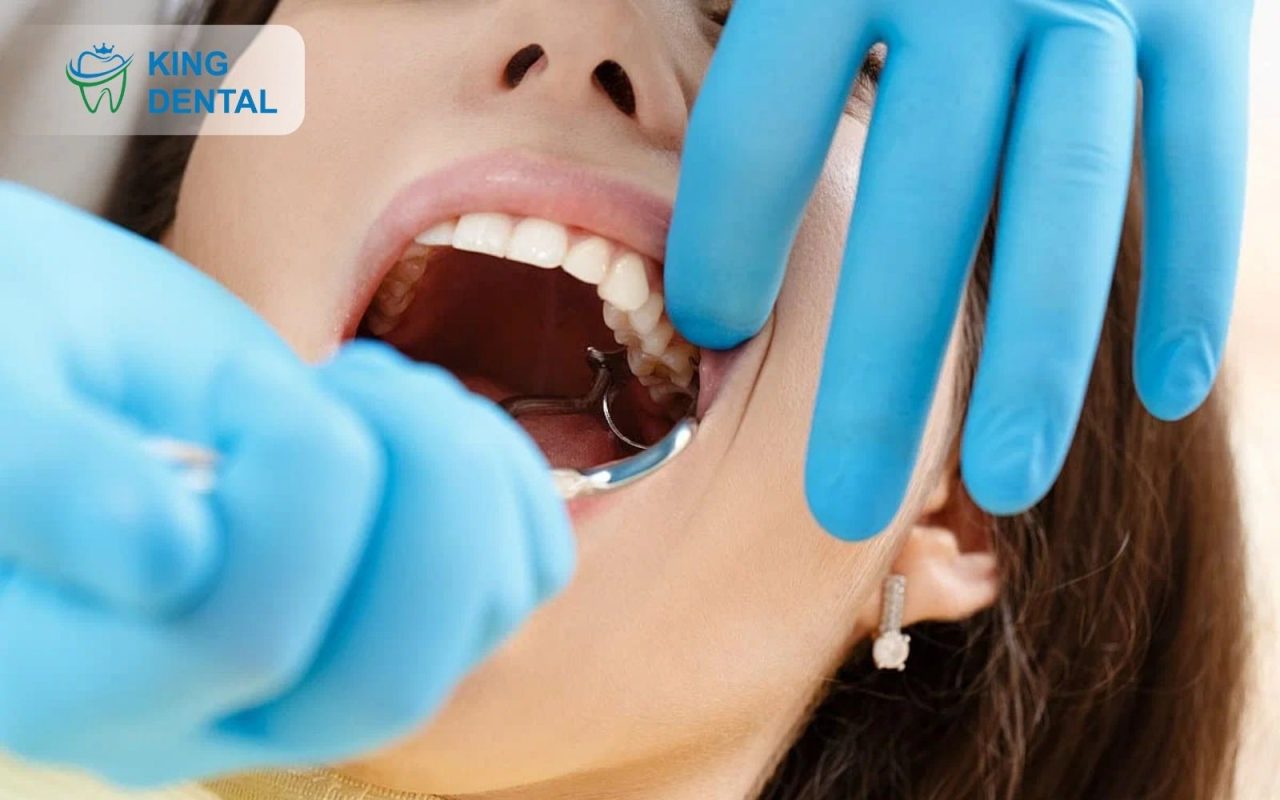 Nhổ răng khôn truyền thống