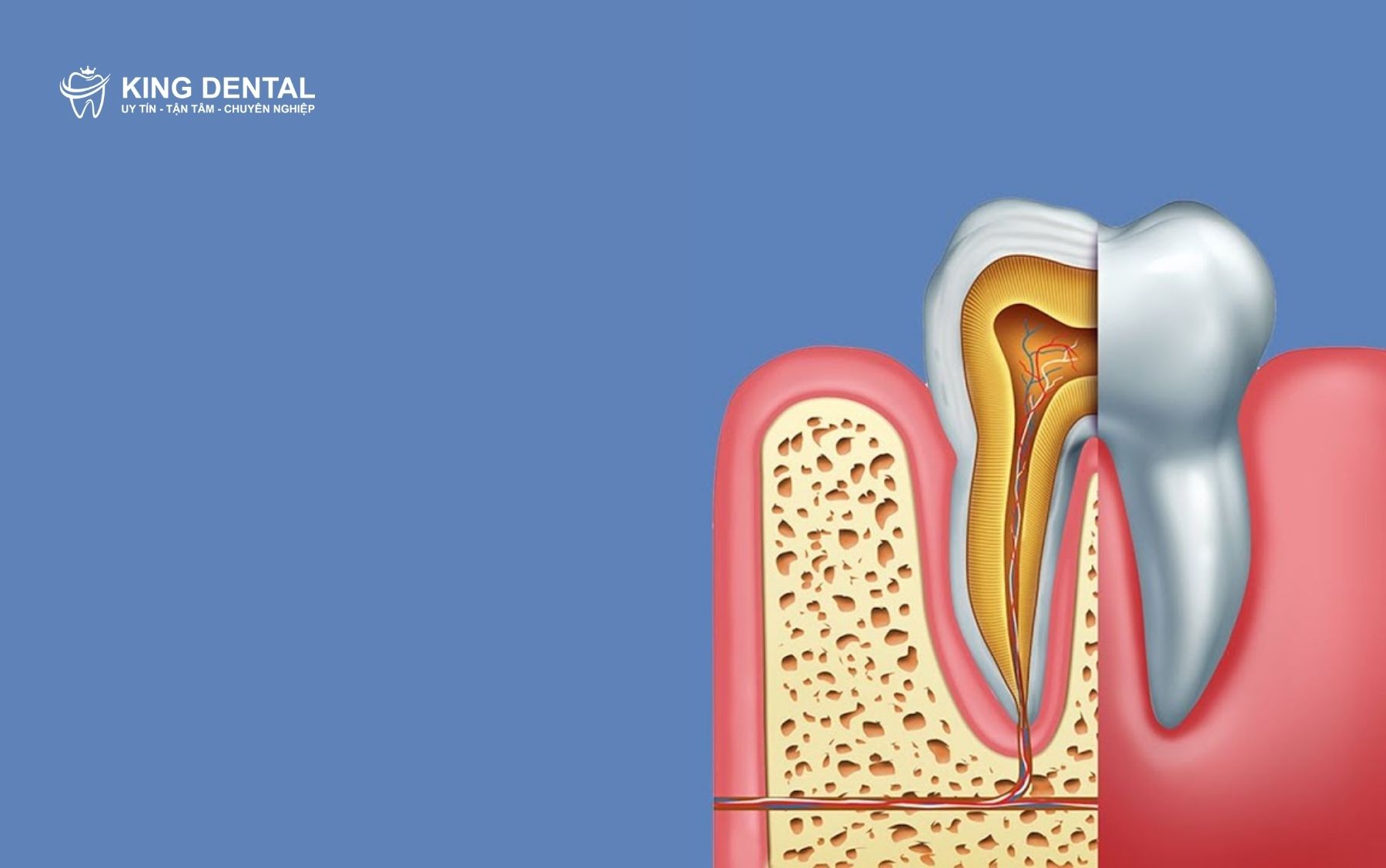 Dấu hiệu răng khôn mọc thẳng